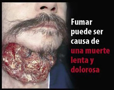 El libro para las mujeres como a dejar fumar leer onlayn gratis